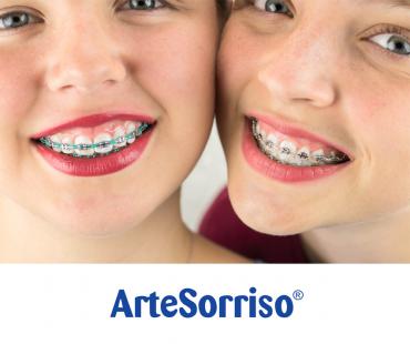 Um melhor sorriso com aparelho ortodôntico