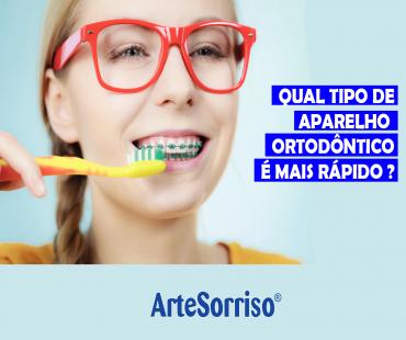 Qual tipo de aparelho ortodôntico é mais rápido ?