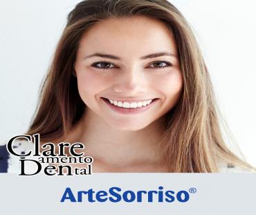 Clareamento dental, tudo que você precisa saber !