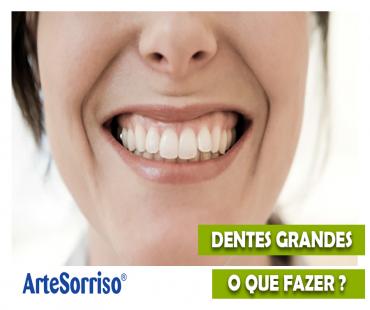 Dentes com tamanhos diferentes. É possível corrigir? 